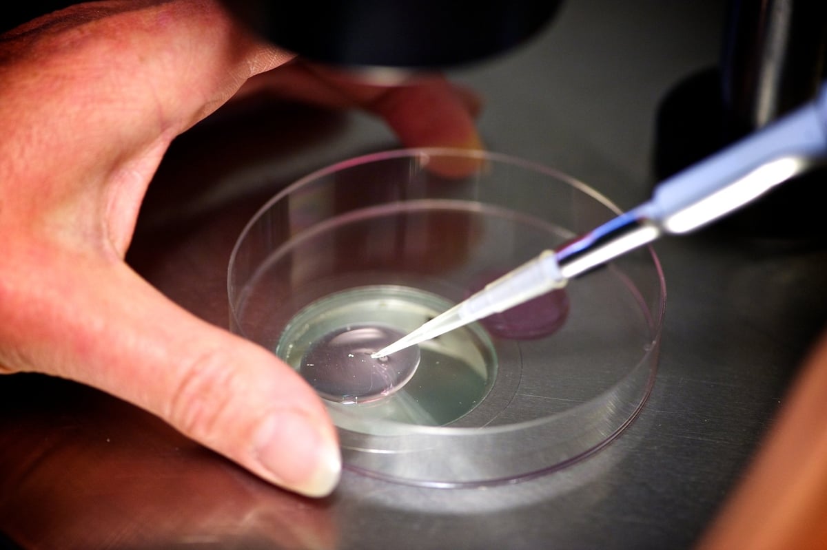 Phương pháp IVF truyền thống vẫn có thể đem lại rủi ro. Ảnh: Getty. Phương pháp IVF truyền thống vẫn có thể đem lại rủi ro. Ảnh: Getty.