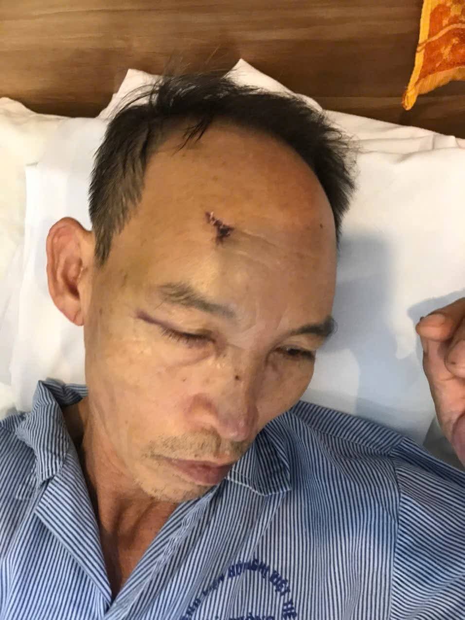 Ông Bùi Văn Dục bị hành hung phải nhập viện. Ảnh: CTV.