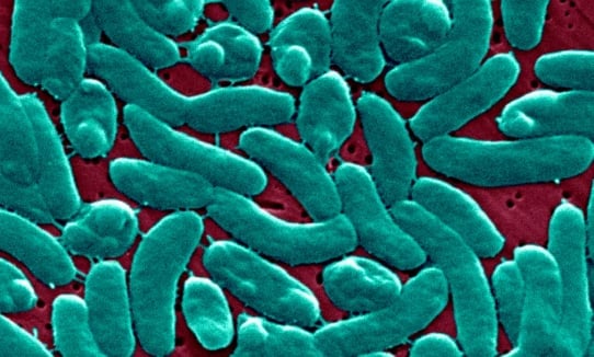 An electron micrograph of Vibrio Vulnificus bacteria. BSIP/Universal Images