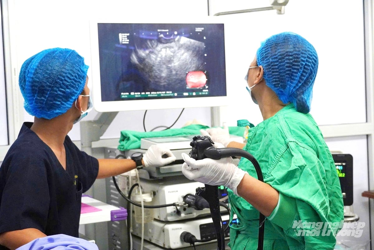 Ê-kíp bác sĩ Bệnh viện Đa khoa Trung ương Cần Thơ thực hiện kỹ thuật nội soi siêu âm đặt stent LAMS dẫn lưu nang giả tụy, dưới sự hỗ trợ của hệ thống nội soi - siêu âm hiện đại, ít xâm lấn. Ảnh: Lê Hoàng Vũ.
