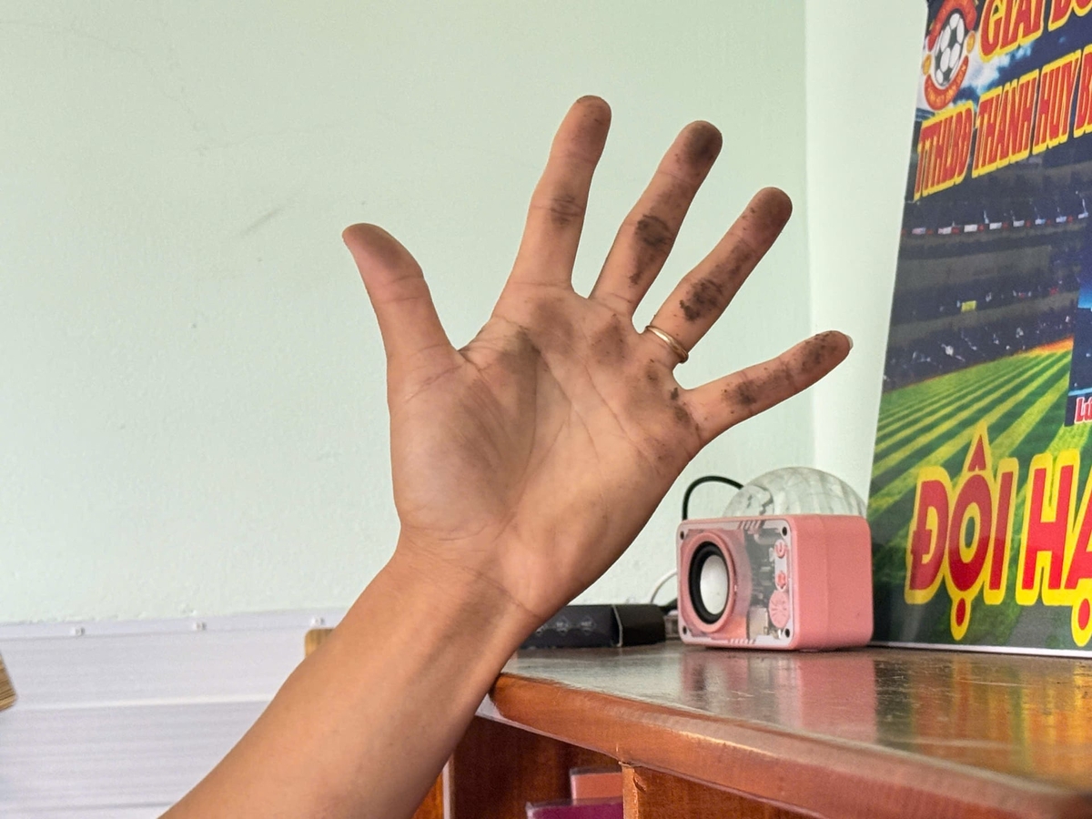 Người dân lo lắng về sức khỏe trước tình trạng ô nhiễm kéo dài. Ảnh: L.K.