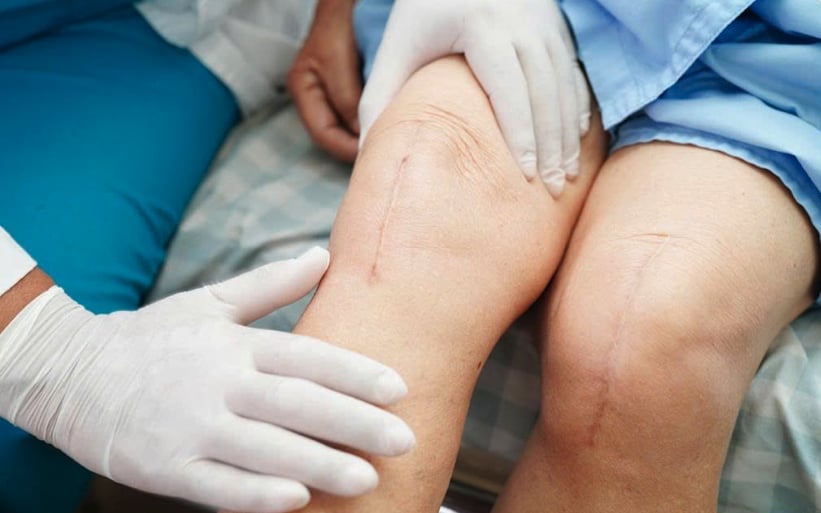 Lối sống ít vận động của giới trẻ là nguyên nhân chính khiến xương khớp lão hóa sớm. Ảnh: Bệnh viện cung cấp.