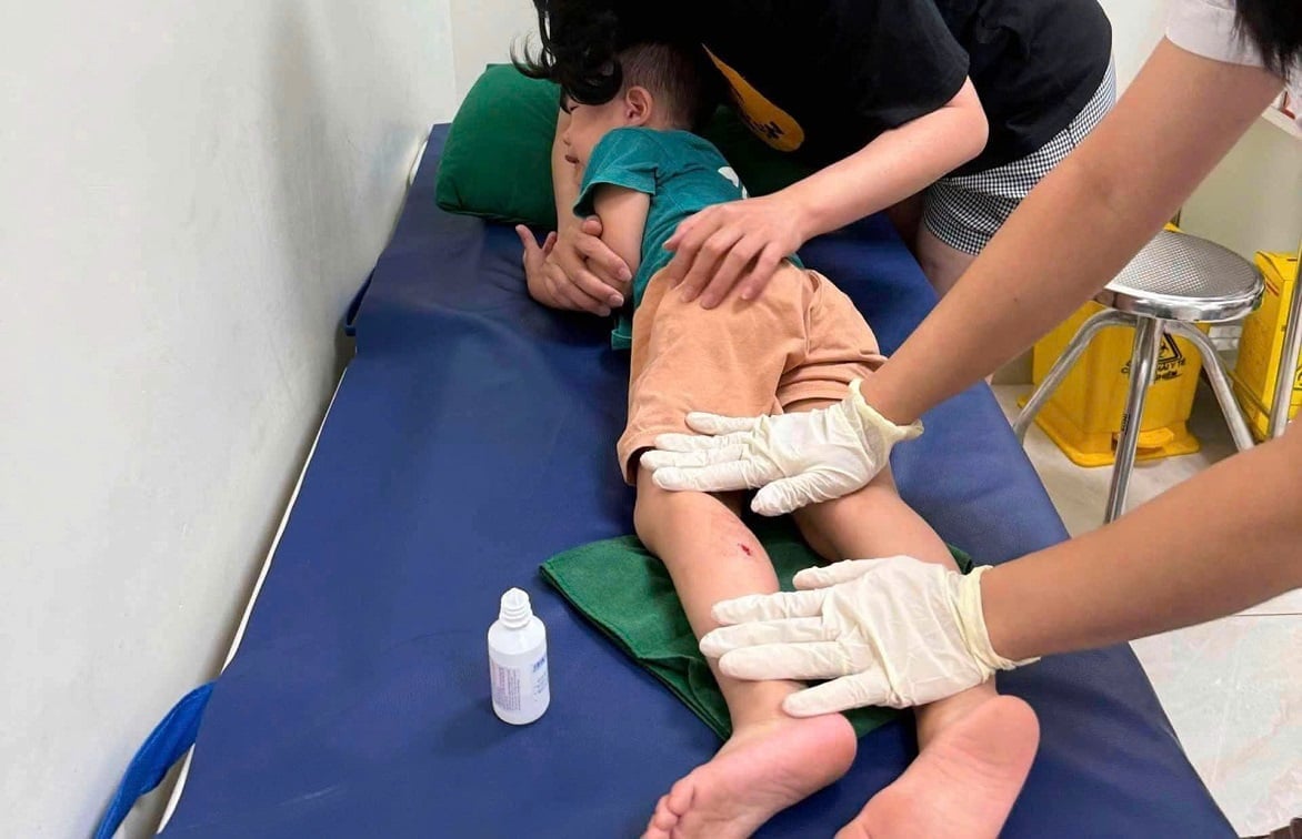 Cháu B. N. K được đưa đến cơ sở y tế kiểm tra, xử lý vết thương sau khi bị khỉ tấn công. Ảnh: Mai Lưu.