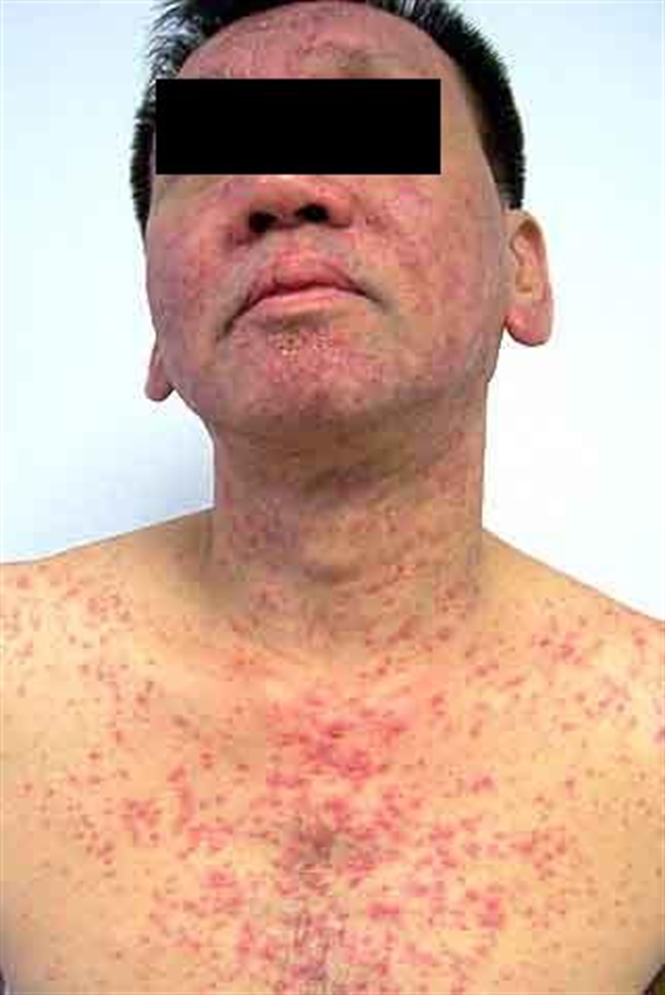 08-31-37_anh-2-bai-bung-phat-cac-dich-vu-kham-chua-benh-trai-phep