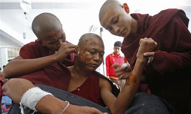 13-06-27_-severely-burnt-buddhist-008