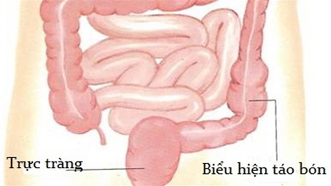 10-44-04_to-bon-1