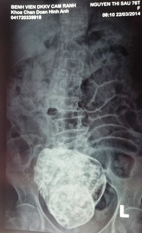 Thai-hoa-da-1-8375-1395987587.jpg