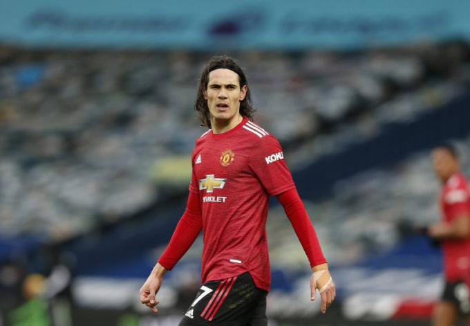 Edinson Cavani sẽ không thể cùng Man United hành quân đến Etihad. Ảnh: Express.