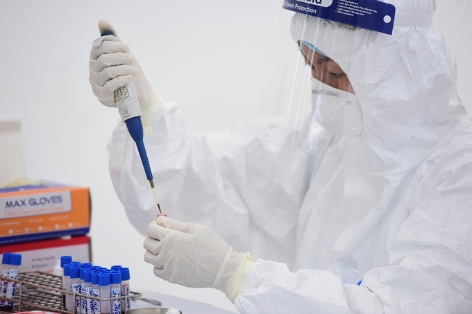 Mẫu xét nghiệm được test nhanh, có kết quả trong 10 phút. Ảnh: Giang Huy.