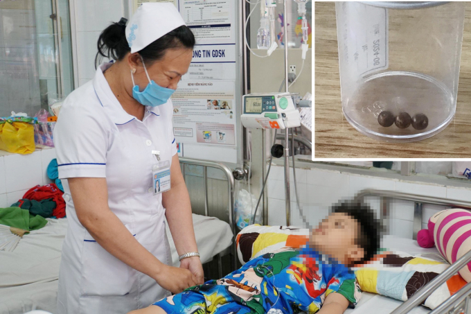 nam-cham-150326_834.jpg Sau khi lấy 3 viên bi nam châm ra khỏi dạ dày bé trai, hiện sức khỏe bé ổn định. Ảnh: P.An.