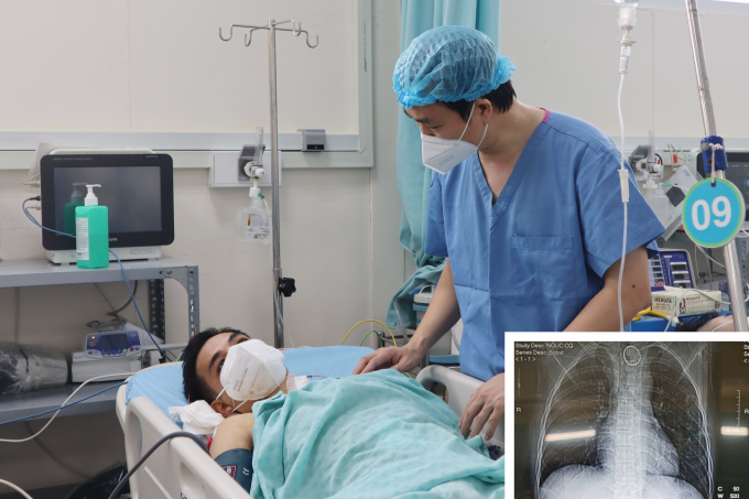 1-115020_879.jpg Bác sĩ thăm khám bệnh nhân sau phẫu thuật. Ảnh: Bệnh viện cung cấp.