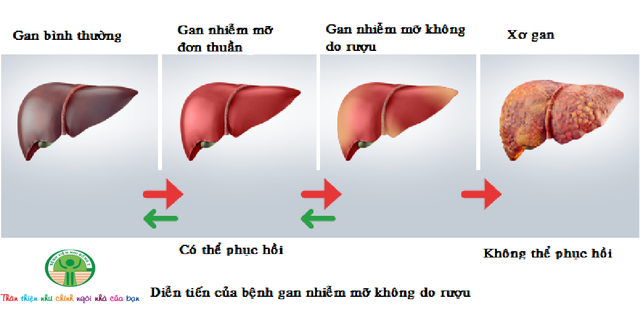 gan-nhiem-mo-1600398346511