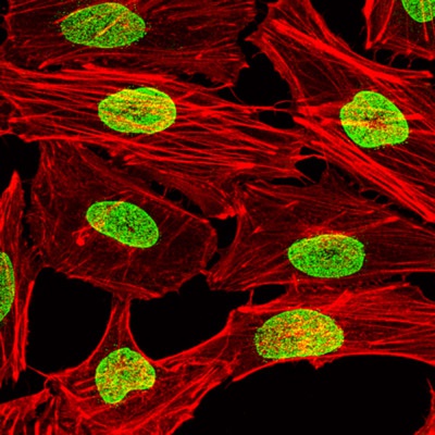 Nuclear_pores_green_actin_filaments_red_cancer_Melanoma_cells_Max_D_Angelo_lab_in