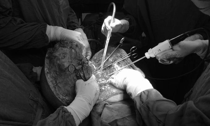 Lẫn phẫu thuật: Chọn xem những bức ảnh xuất sắc về cuộc sống sau khi phẫu thuật và hành trình phục hồi. Hãy tìm hiểu thêm về các loại phẫu thuật khác nhau và những kỹ thuật y tế tiên tiến nhất hiện nay.