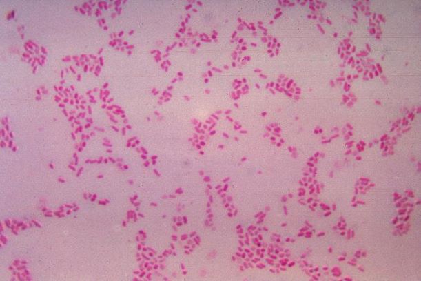 BacteroidesFragilis_Gram1