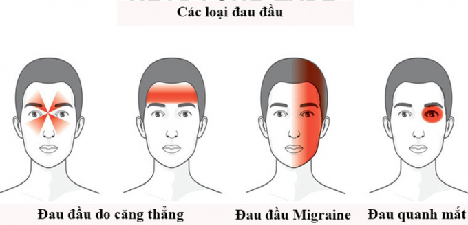 dau-dau-migraine-1_800x386