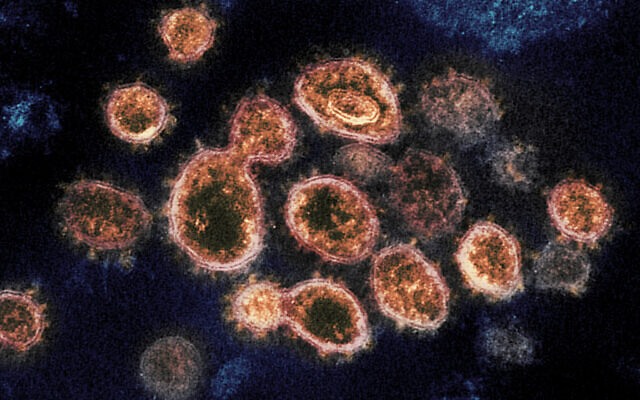 Virus SARS-CoV-2. Ảnh: Viện Dị ứng và các bệnh truyền nhiễm Mỹ NIAID