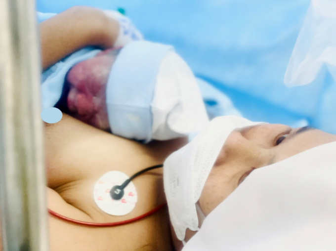 Trẻ được da kề da với mẹ (nhiễm COVID-19) sau khi chào đời. Nguồn ảnh: Vietnamnet