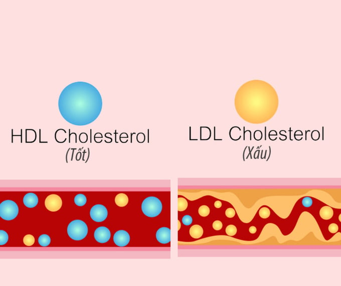 Cholesterol HDL - Cholesterol LDL