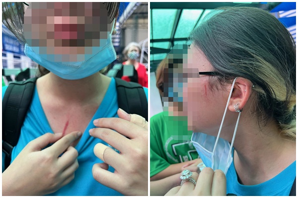 Hình ảnh học sinh bị thương sau khi đánh nhau ở trường quốc tế ISHCMC - American Academy