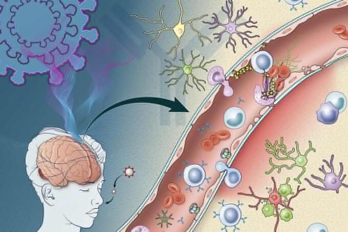 Nhiễm trùng SARS-CoV-2 được phát hiện có khả năng kích hoạt sản xuất các phân tử miễn dịch làm tổn thương các tế bào lót các mạch máu trong não. Ảnh: New Atlas