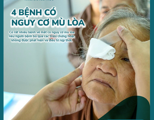 4 bệnh về mắt có nguy cơ gây mù lòa nếu không được điều trị kịp thời. Ảnh: BVMHN