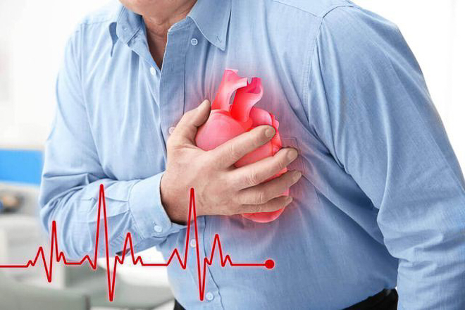 Các bệnh lý về tim mạch được mệnh danh là những “sát thủ thầm lặng”. Ảnh minh họa