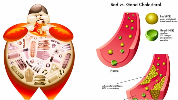 Vì sao tết lại ảnh hưởng tiêu cực đến người bệnh mỡ máu cao? Ảnh minh họa