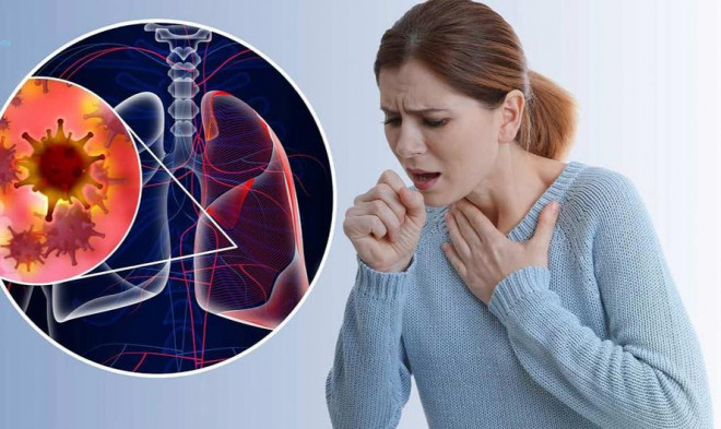 Các bệnh thường gặp ở phổi. Ảnh minh họa