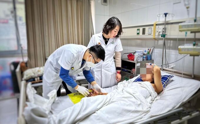 Chăm sóc bệnh nhân bị chấn thương do pháo nổ tự chế tại Bệnh viện Hữu nghị Việt-Đức. Ảnh: HNM