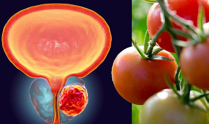 Ăn nhiều cà chua có thể giảm nguy cơ ung thư tuyến tiền liệt. Ảnh: CNA