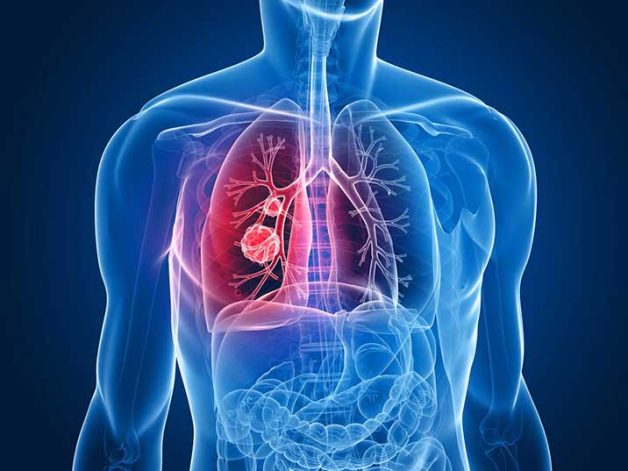 lung-anatomy-v2-e1674022062311