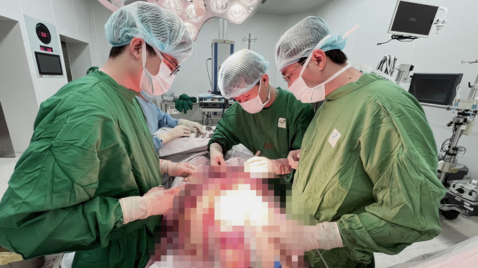 Đội ngũ các chuyên gia khoa Phẫu thuật Tim mạch tiến hành mở ngực