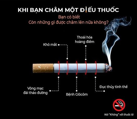 Ảnh: Bệnh viện Mắt Hà Nội 2