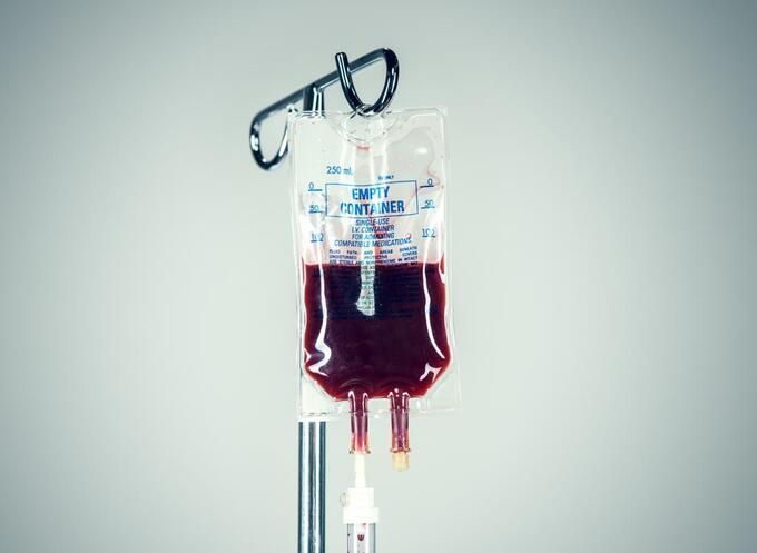how-long-does-a-blood-transfusion-last