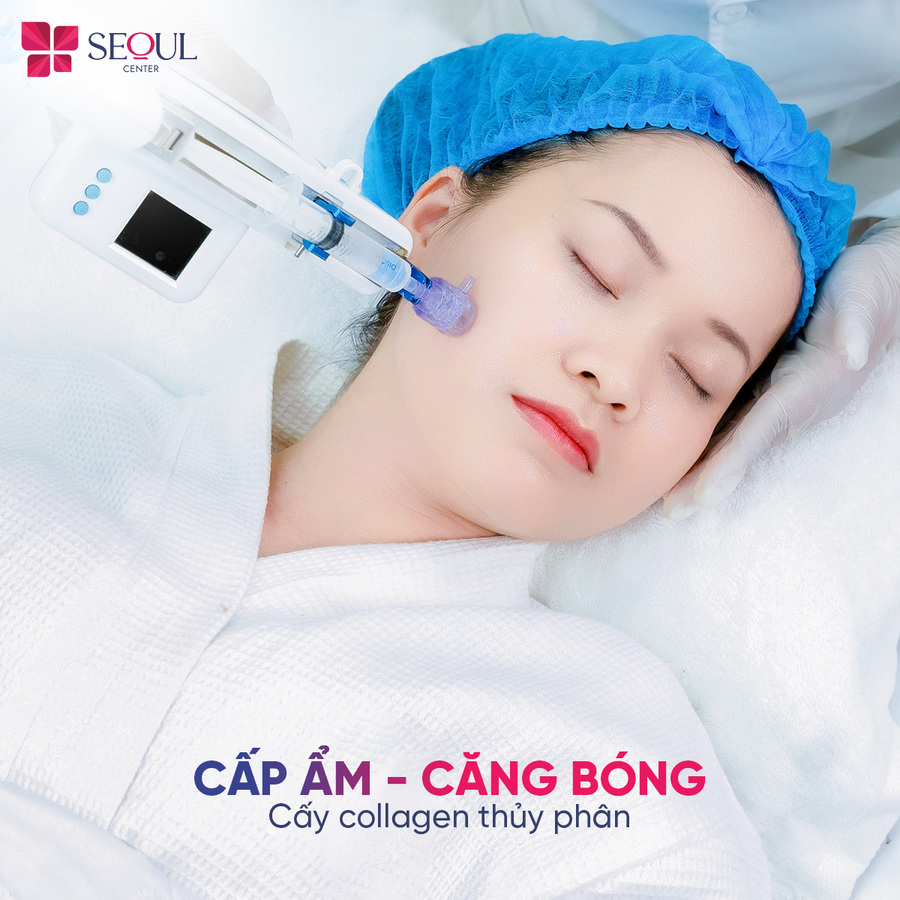 Cấy Collagen thủy phân là liệu pháp trẻ hóa da chuyên sâu hỗ trợ cấp ẩm và duy trì độ căng bóng da