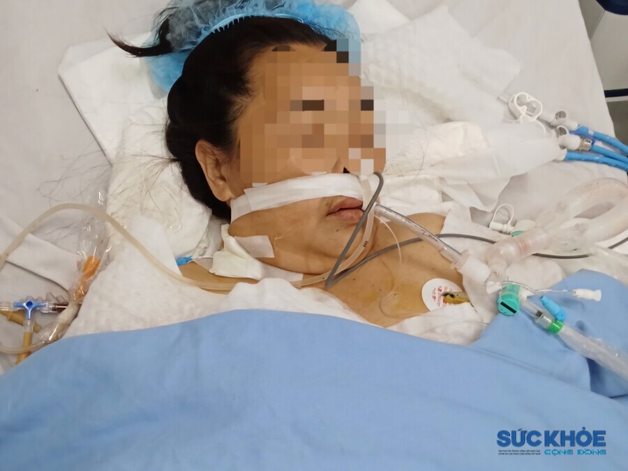 Chị Bùi Thị N. thời điểm cấp cứu tại Bệnh viện Đa khoa tỉnh Thanh Hóa 