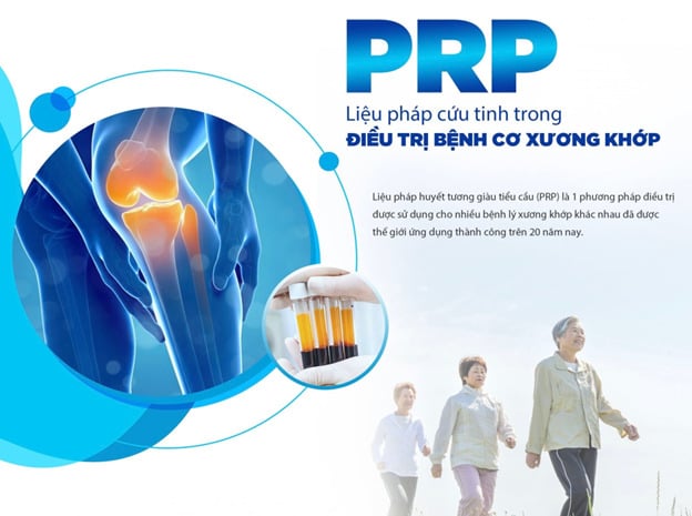 PRP là công nghệ tiên tiến 4.0 trong ngành y có tính chữa lành cho nhiều vấn đề da, cứu tinh trong điều trị bệnh cơ xương khớp