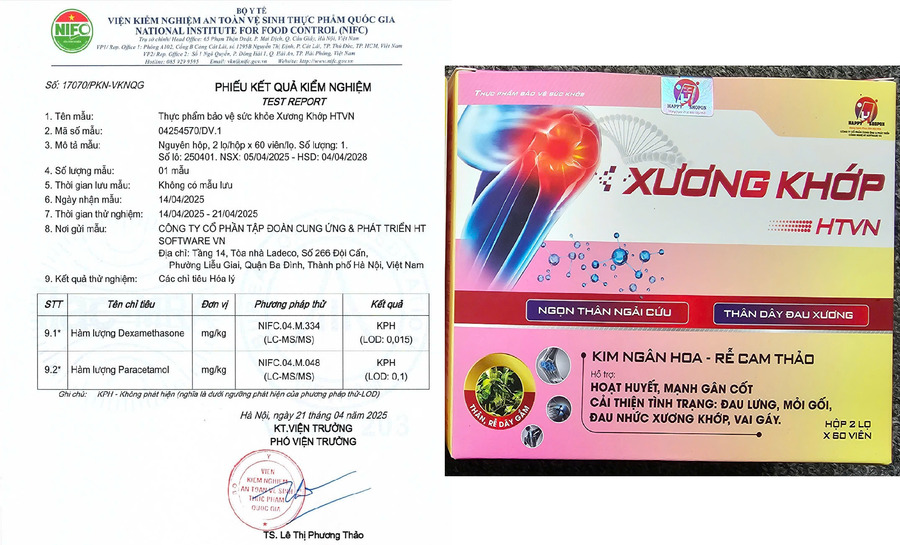 anh dai dien xuong khop HTVN