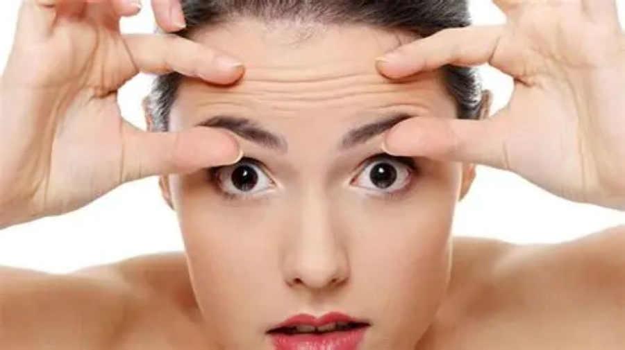 Nếp nhăn trên trán mới hình thành sẽ dễ cải thiện hơn (Ảnh minh họa)