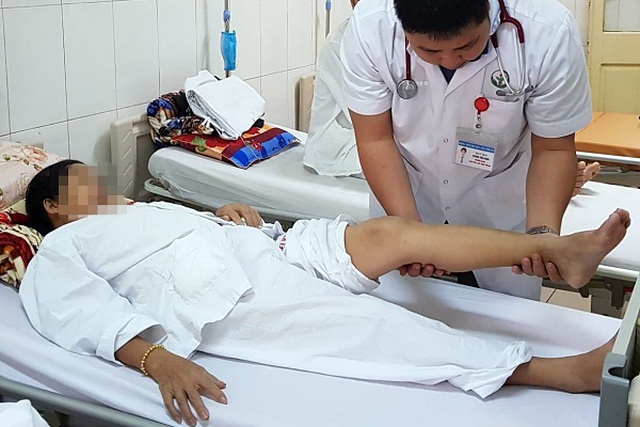 70% nữ giới bị suy giãn tĩnh mạch chân: Chuyên gia Bệnh viện Việt Đức khuyến cáo gì? - Ảnh 1.