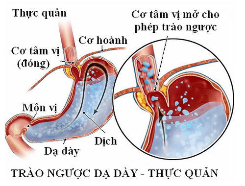 nong rat co hong la dau hieu benh  gi 1