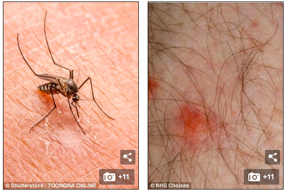 Muỗi (trái) mang nhiều mầm bệnh nguy hiểm, vết muỗi đốt cần được rửa bằng xà phòng và nước
