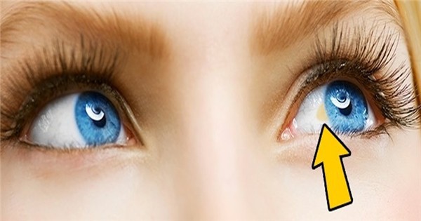 Dấu hiệu cảnh báo bệnh tật từ đôi mắt, phải đi khám ngay nếu không muốn mù lòa - Ảnh 2.