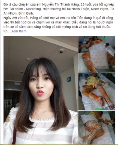 Vụ nữ sinh viên bị bỏng xăng cháy toàn thân ở xã Nhơn Hạnh, thị xã An Nhơn, Bình Định
