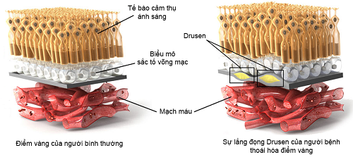 thoai hoa diem vang o mat co nguy hiem khong.jpg 1