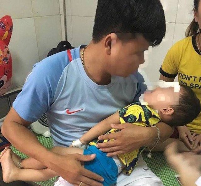 Cháu .H.Y (31 tháng tuổi, trú tại xã Nam Sơn, huyện Đô Lương, Nghệ An) được đưa đến bệnh viện trong tình trạng vùng mặt cháu bị nhiều vết thương hở, chảy máu nhiều
