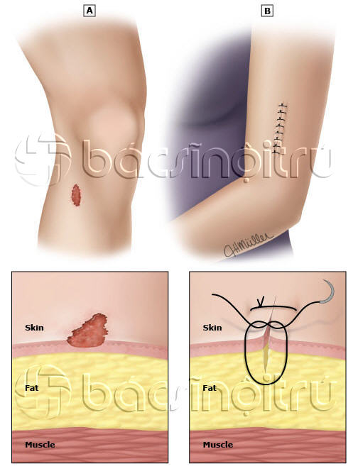 9 bước sơ cứu vết cắt và vết cào xước - Ảnh 1.