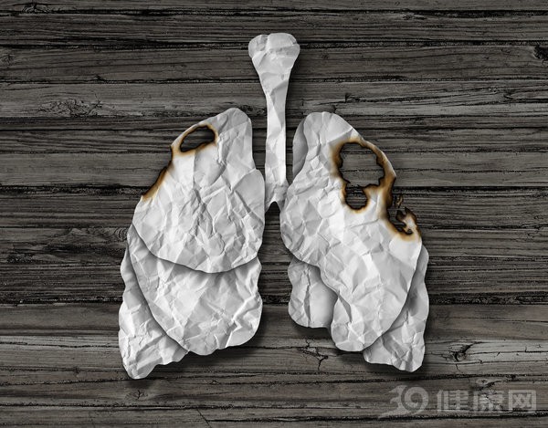 Ung thư phổi tiên lượng xấu nếu phát hiện muộn: Chỉ cần có dấu hiệu này là phải khám ngay! - Ảnh 3.