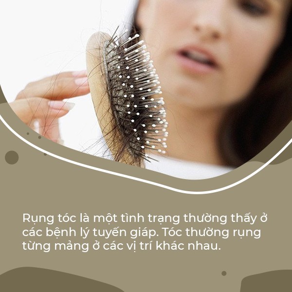 Tại sao rụng tóc lại liên quan đến rối loạn chức năng tuyến giáp? - Ảnh 1.